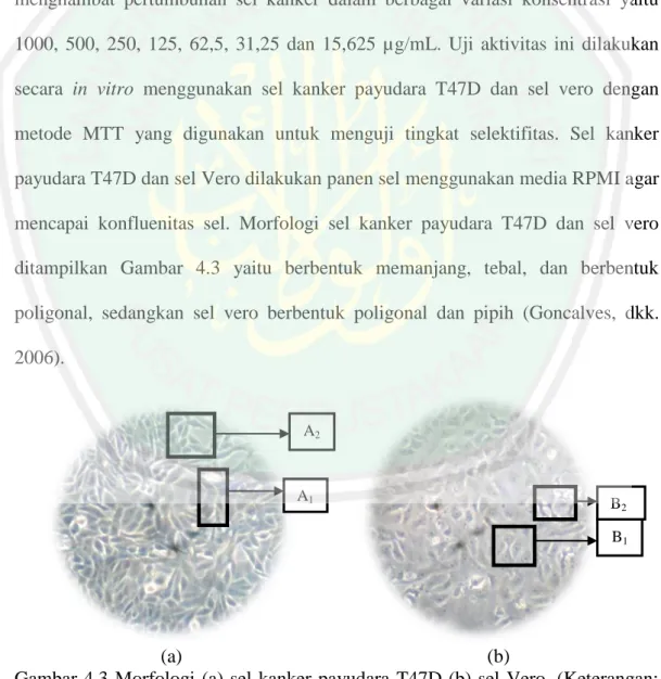 Gambar  4.3  Morfologi  (a)  sel  kanker  payudara  T47D  (b)  sel  Vero.  (Keterangan: 