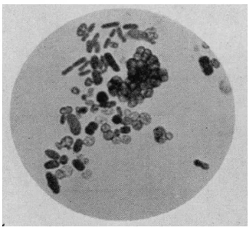 Gambar II.10. Gambar bakteri Azotobacter  