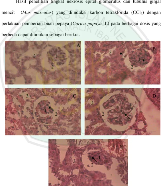 Gambar  4.1.  Anatomi  glomerulus  dan  tubulus  ginjal  mencit  kontrol  negatif  (A); 