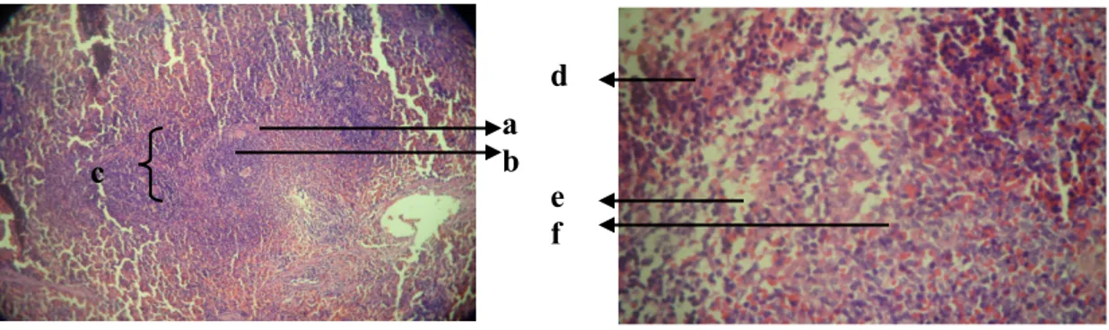 Gambar 2.  Gambaran mikroskopis histopatologik limpa pada ketiga kelompok ( a: 