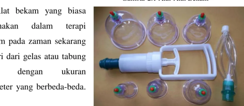 Gambar 2.1 Alat-Alat Bekam 