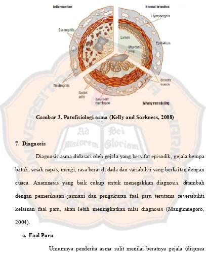 Gambar 3. Patofisiologi asma (Kelly and Sorkness, 2008) 