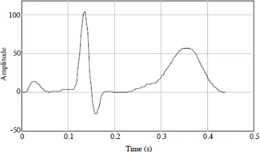 Gambar 2.4 Sinyal Low Pass Filter ECG 
