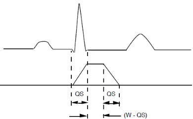 Gambar 2.9 Hubungan Kompleks QRS dengan Bentuk Gelombang Integrasi Bergerak  