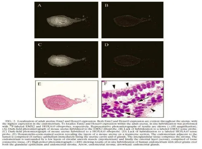 Gambar 5. Ekspresi dan pewarnaan HOXA 10 pada dinding endometrium 