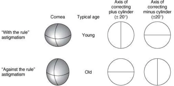 Gambar 2.7. Jenis astigmatisme seperti yang ditentukan oleh orientasi meridian-  meridian utama dan orientasi sumbu silinder pengoreksi  Sumber: Oftalmologi Umum, Riordan, 2014 