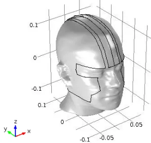 Gambar 3.2   Desain geometri kepala manusia dengan ECCT 