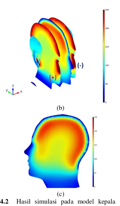 Gambar 4.2  Hasil simulasi pada model kepala manusia 3 