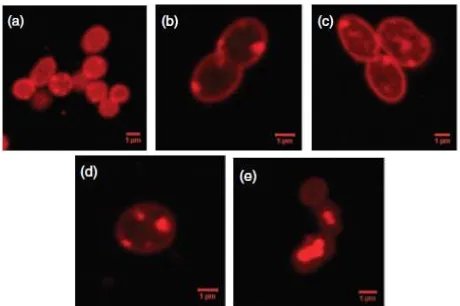 Gambar 2.3. Genus  Fluorescence a) Inkubasi 0 jam, b) 1 jam, c) 2 jam, d) 3jam, dan e) 16 Jam  (Hermawan & Jendrossek, 2007) Azotobacter diamati dengan Laser Scanning  