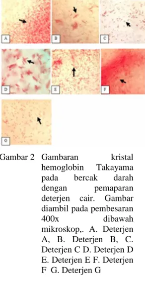 Gambar 2 Gambaran  kristal hemoglobin  Takayama pada  bercak  darah dengan  pemaparan deterjen  cair