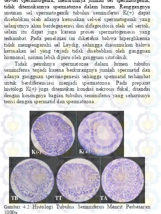 Gambar 4.2  Histologi Tubulus Seminiferus Mencit Perbesaran 