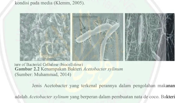 Gambar 2.2 Kenampakan Bakteri Acetobacter xylinum  (Sumber: Muhammad, 2014) 