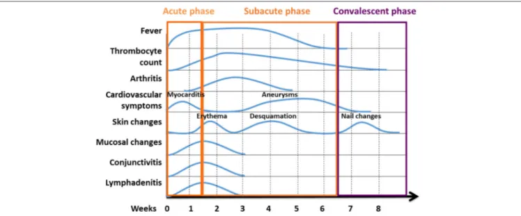 FIGURE 3 | Phases of KD are characterised by variable clinical symptoms. Kawasaki disease reconstitutes a systemic inflammatory disorder with an acute, subacute, and convalescent/recovery phases