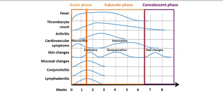 FIGURE 3 | Phases of KD are characterised by variable clinical symptoms. Kawasaki disease reconstitutes a systemic inflammatory disorder with an acute, subacute, and convalescent/recovery phases