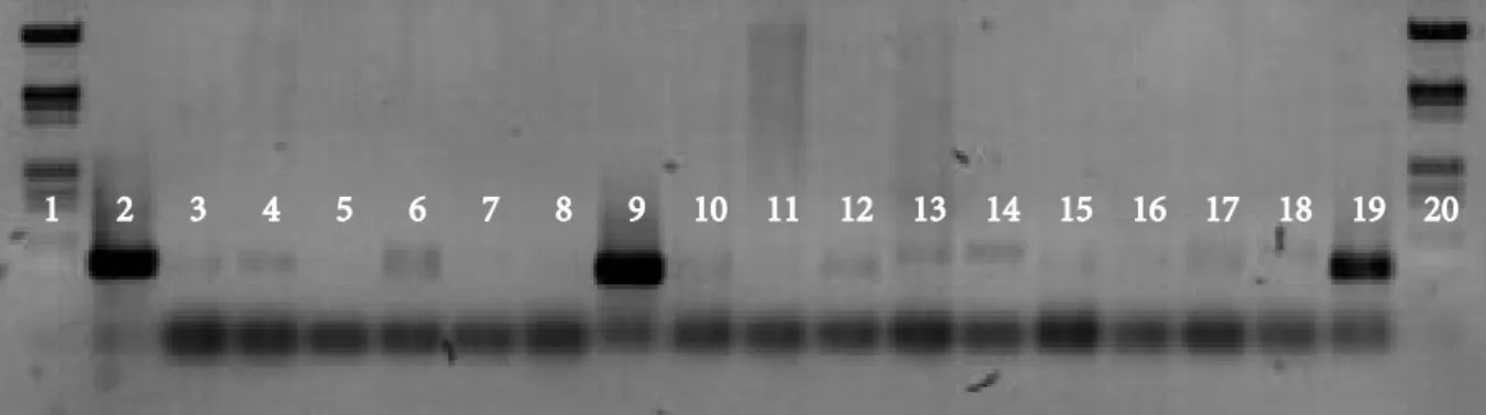 Gambar 2.  Amplifikasi PCR sampel DNA biakan Phytophthora dan biakan yang didapatkan dari umpan pada  kartu FTA menggunakan primer ITS-1F/ITS 4