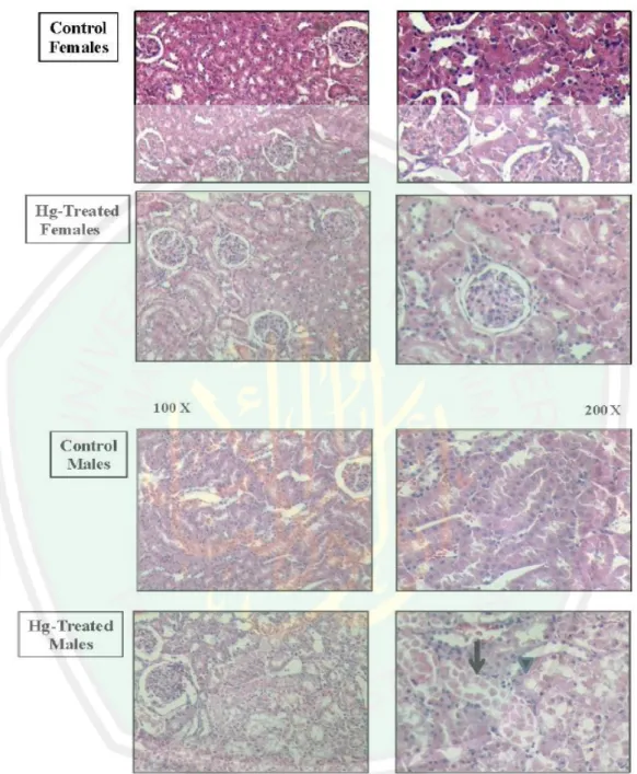 Gambar  2.4  Gambaran  histopatologi  ginjal  tikus  menggunakan  pewarna  HE  (Hematoxylin/Eosin) pada perbesaran 100x dan 200x pada 18 jam  setelah pemaparan merkuri (Hazzelhoff et al., 2012 )