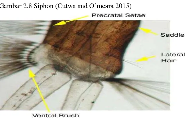 Gambar 2.8 Siphon (Cutwa and O’meara 2015) 