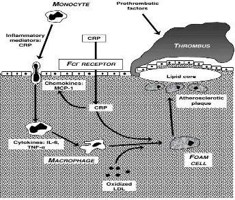 Gambar 2.4. Proses inflamasi yang terlibat pada atherosklerosis. 