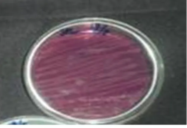 Gambar 7. Biakan bakteri E-coli pada media  agar 