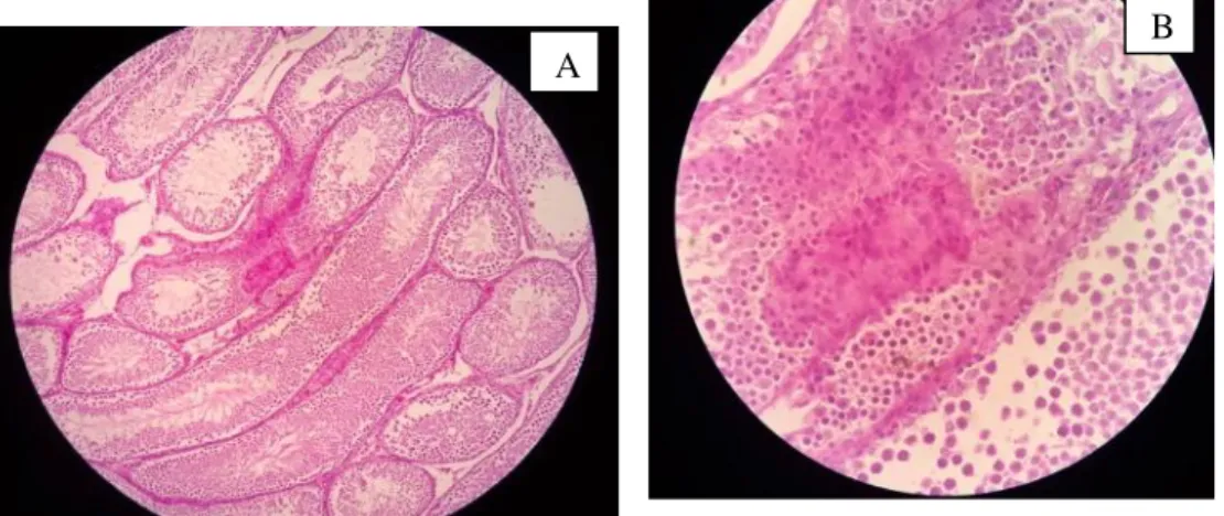 Gambar di atas menunjukkan sel  Leydig pada interstitial yang masih terlihat normal,  tidak terlihat adanya perubahan morfologi berupa gerombolan sel Leydig