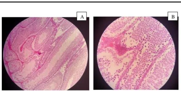 Gambar 5 : Gambar histopatologis kelompok perlakuan 4 dengan perbesaran   (A) 100X, (B) 400X