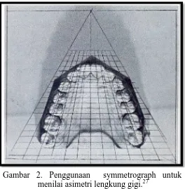 Gambar 2. Penggunaan  symmetrograph untuk menilai asimetri lengkung gigi. 27 