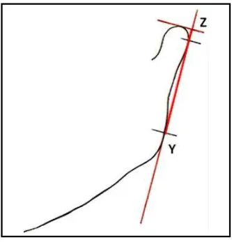 Gambar 2.9.  Metode pengukuran tinggi ramus Z-Y berdasarkan Habet dkk. Y, titik terendah dari tepi posterior ramus yang paling menonjol; Z, perpotongan antara 2 garis singgung yaitu garis singgung Y (tangen ramus) yang tegak lurus terhadap garis singgung yang melalui bagian atas kondilus (tangen kondilus).2    