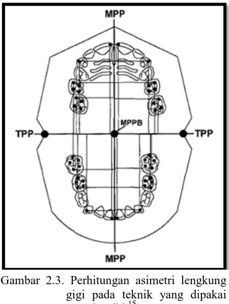 Gambar 2.3. Perhitungan asimetri lengkung gigi pada teknik yang dipakai  