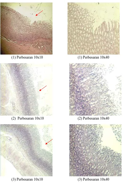 Gambar histologi jaringan lambung tikus kelompok pengobatan selama 2 hari dengan sediaan beads floating mukoadhesif yang mengandung Al(OH) dan Mg(OH) 