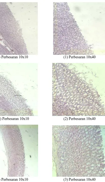Gambar histologi jaringan lambung tikus kelompok pengobatan selama 4 hari dengan sediaan beads floating mukoadhesif yang mengandung Al(OH) dan Mg(OH) 