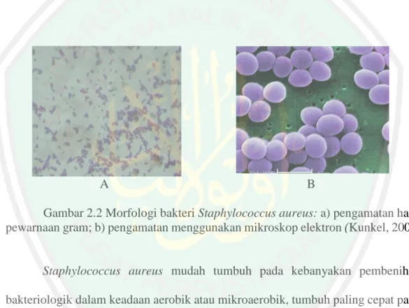 Gambar 2.2 Morfologi bakteri Staphylococcus aureus: a) pengamatan hasil  pewarnaan gram; b) pengamatan menggunakan mikroskop elektron (Kunkel, 2004) 