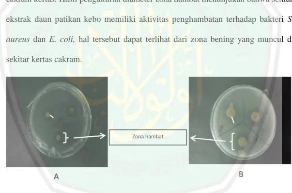 Gambar 2.5 Zona hambat pada uji antimikroba menggunakan kertas cakram; a)  bakteri E. coli; b) bakteri S
