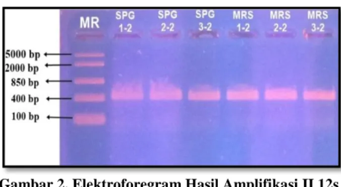 Gambar 1. Elektroforegram Hasil Amplifikasi I 12s  rRNA 
