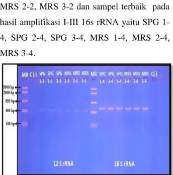 Gambar 7. Elektroforegram Hasil Amplifikasi II 16s  rRNA 