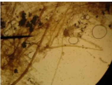 Gambar 8. Mikroskopis R. oryzae pada perbesaran 100× 
