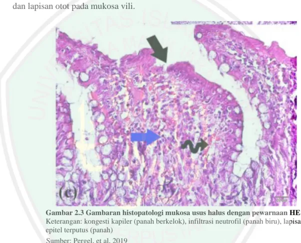Gambar 2.3 Gambaran histopatologi mukosa usus halus dengan pewarnaan HE.  