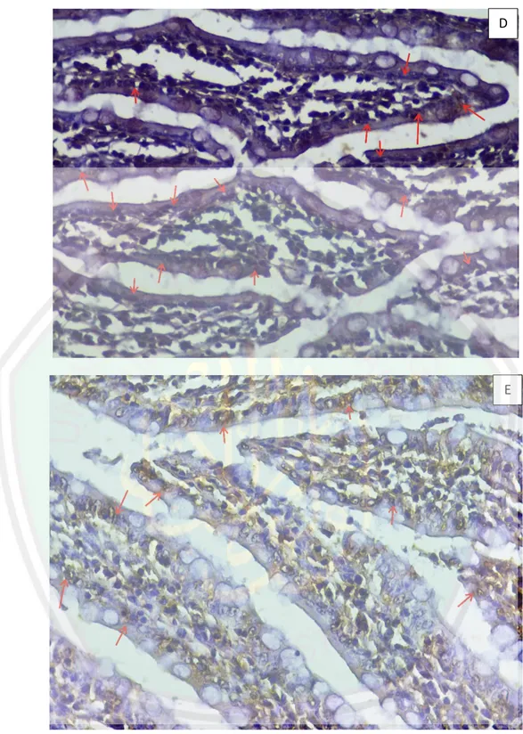 Gambar  5.2  Gambaran  Histopatologi  sel  mukosa  epitel  usus  halus  dengan  pewarnaan  pewarnaa imunohistokimia caspase-3 pada perbesaran 400x
