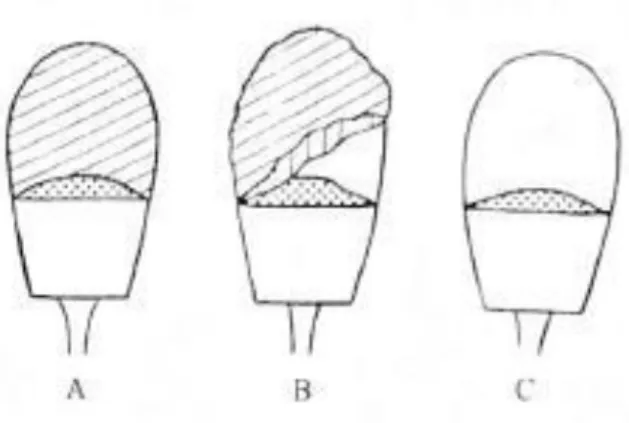 Ilustrasi 2. Tudung Akrosom Utuh (A); Tudung Akrosom  Terlepas Sebagian (B); Tudung Akrosom Terlepas Seluruhnya 