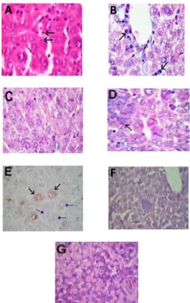 Gambar  5.  Histopatologi  Hepar  dengan  pewarnaan  Hematoxillin-Eosin dan Immunohistokimia (1000x)
