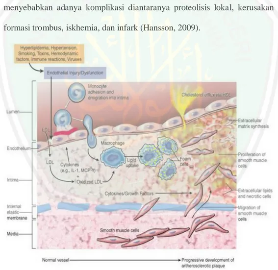 Gambar 2.1 Patogenesis aterosklerosis (Wihastuti, Sri, dan Teuku, 2016) 