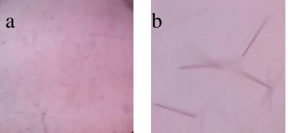 Gambar  4.9  :  Hasil  pemeriksaan  kristal  hemokromogen  zat  paparan  1.  (a)  mikroskop perbesaran 400x, (b) gambar a perbesaran 150x 
