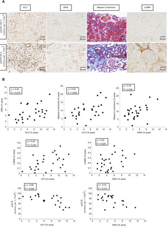 Figure 7.  HIRA expression correlates with the expression of histone H3.3, the degree of fibrosis and estimated  glomerular filtration rate (eGFR) in human kidney biopsy specimens (n = 28)