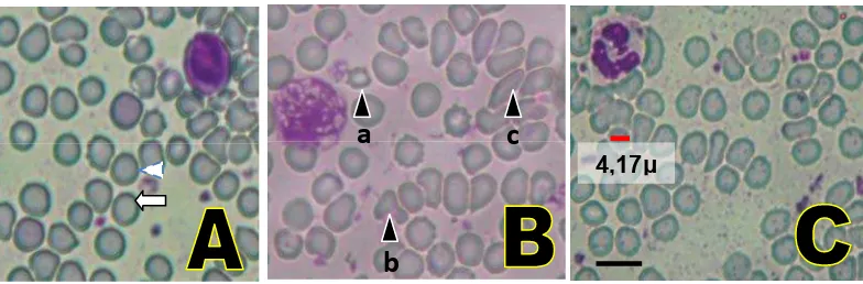 Gambar 10. Gambar morfologi dan ukuran sel darah merah dengan pembesaran 800x dengan pewarnaan Giemsa  pada mencit jantan setelah perlakuan, (A) Bentuk darah yang normal, oval (     ) dari slide Po sebagai kontrol; (B) bentuk darah yang abnormal; a