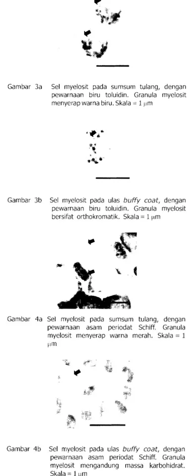 Gambar  2a.  Sel  Myelosit  pada  sumsum  tulang,  dengan  pewarnaan  May-Grunwald  Giemsa