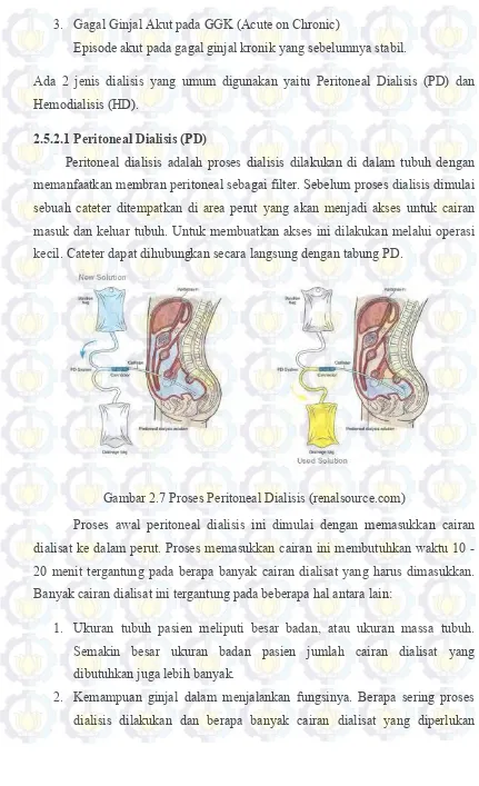Gambar 2.7 Proses Peritoneal Dialisis (renalsource.com) 