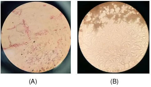 Gambar 4. 3 Bentuk Koloni Jamur Aspergillus niger.