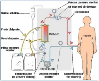 Gambar 8. Proses hemodialisis 