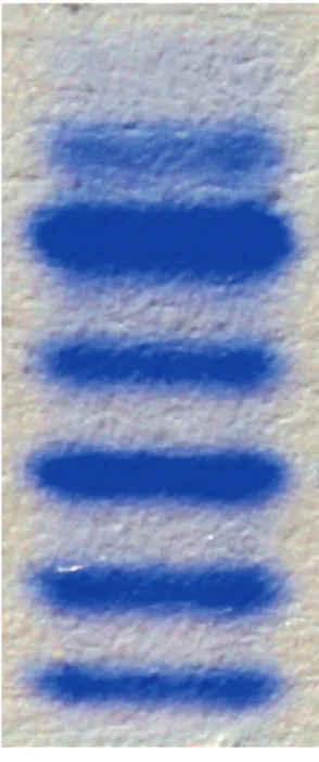 Foto 2. CDG-II muster,  tri-, di-, mono- ja  asialotransferriini  vöötide intensiivsuse  suurenemine
