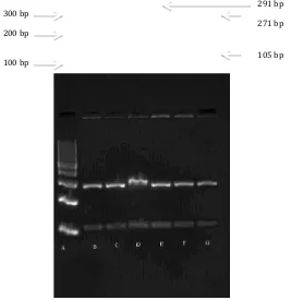 Gambar Hasil Elektroforesis RFLP Apolipoprotein A5 -1131T>C 
