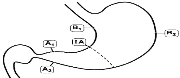 Gambar 22. Skema daerah yang direkomendasikan untuk biopsi. Satu spesimen harus berasal dari daerah curvatura minor (A1) dan curvatura mayor (A2) daerah antrum yauitu kedua duanya berjarak 2-3 cm dari pylorus ; dari curvatura minor corpus sekitar 4 cm prox